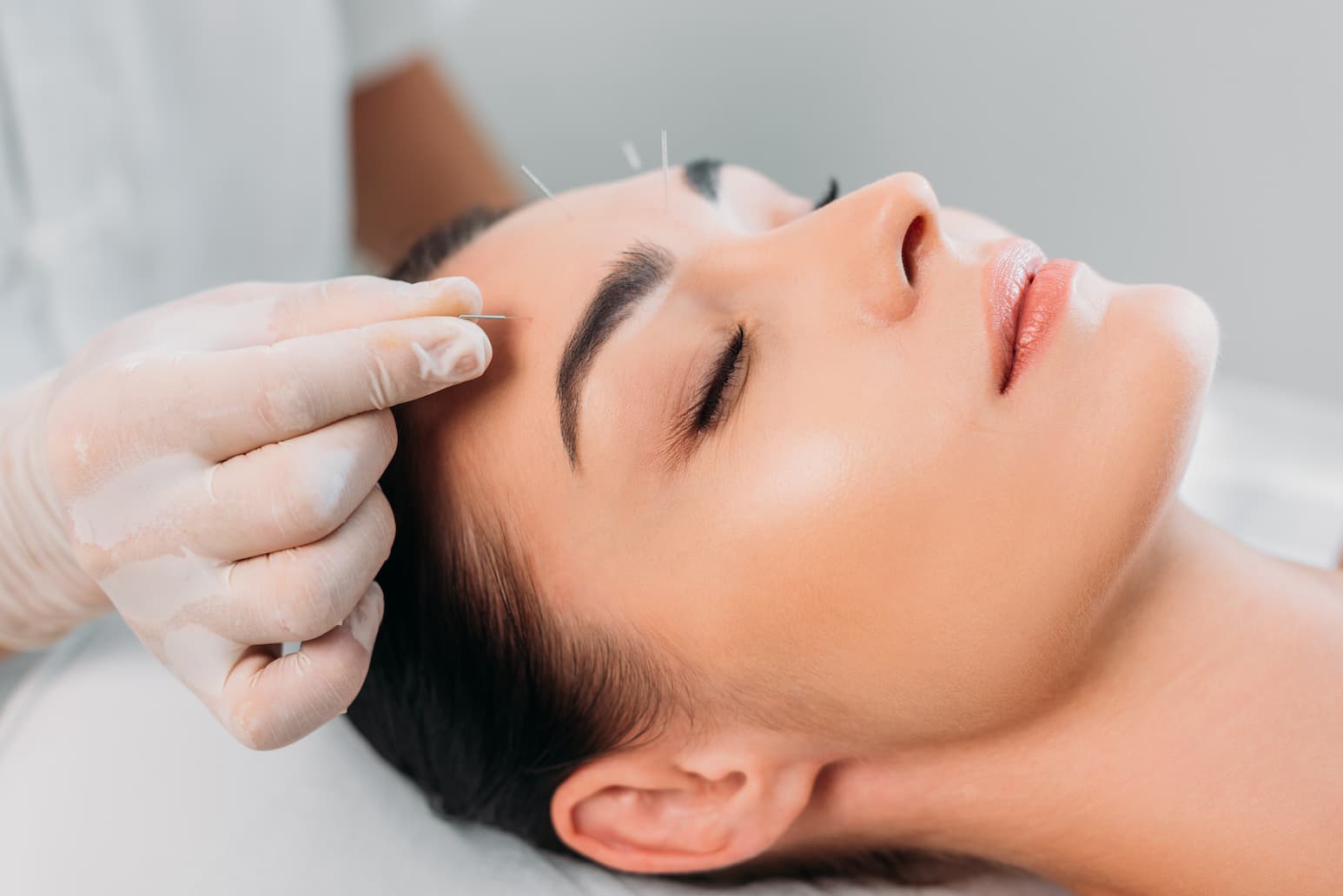 More Than Acupuncture